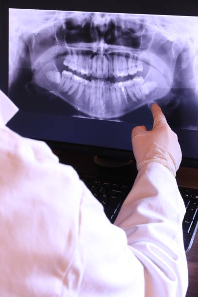 Best Emergency Tooth Extraction in Lusk, WY